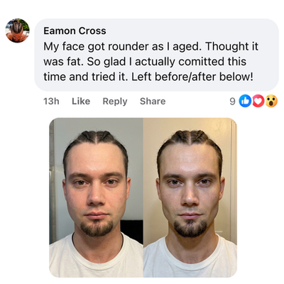 Leveld Labs Face Debloat Powder